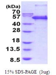 Human PEPD protein, His tag. GTX67623-pro