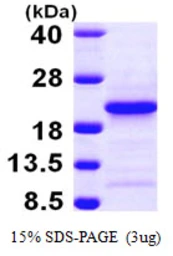 Human PFDN4 protein, His tag. GTX67625-pro