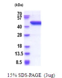 Human SerpinB8 protein, His tag. GTX67637-pro