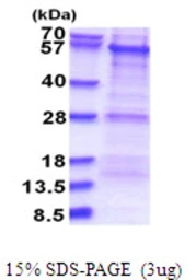 Human PKNOX1 protein, His tag. GTX67639-pro