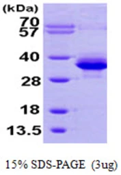 Human PMM1 protein, His tag. GTX67640-pro