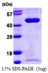 Human SEPT5 protein, His tag. GTX67645-pro
