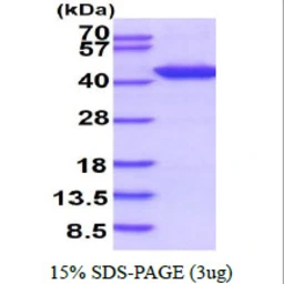 Human DNA polymerase beta protein, His tag. GTX67646-pro