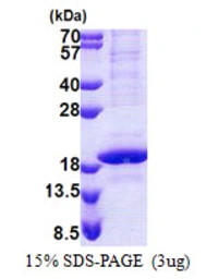 Human POLR2D protein, His tag. GTX67648-pro