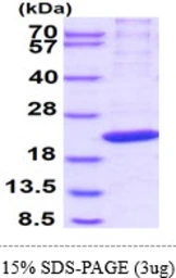 Human RPB8 protein, His tag. GTX67651-pro