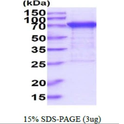 Human PPM1G protein, His tag. GTX67659-pro