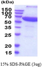 Human PPP2R1A protein, His tag. GTX67663-pro