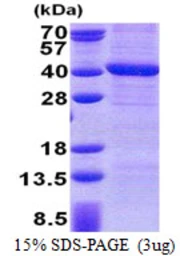 Human PPP4C protein, His tag. GTX67665-pro