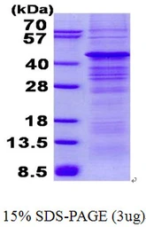 Human AMPK beta 1 protein, His tag. GTX67668-pro