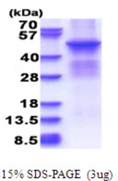 Human PKA beta (catalytic subunit) protein, His tag. GTX67671-pro