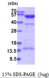 Human PKA R2 protein, His tag. GTX67674-pro