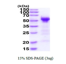 Human JNK3 protein, His tag. GTX67680-pro