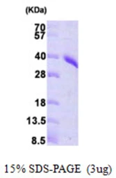 Human PRPS1 protein, His tag. GTX67685-pro