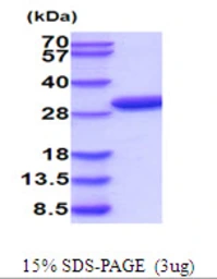 Human PRPS2 protein, His tag. GTX67686-pro