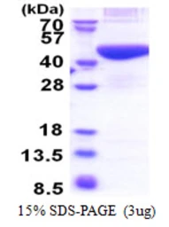 Human PRPSAP2 protein, His tag. GTX67687-pro