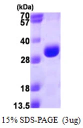 Human PSMA3 protein, His tag. GTX67691-pro