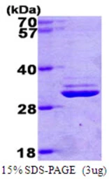Human PSMA7 protein, His tag. GTX67695-pro