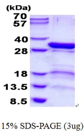 Human PSMD9 protein, His tag. GTX67699-pro