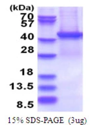 Human PSMD13 protein, His tag. GTX67702-pro