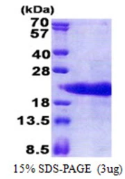 Human PTMA protein, His tag. GTX67708-pro