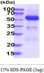 Human SHP2 protein, His tag. GTX67711-pro