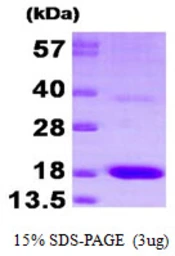 Human PTS protein, His tag. GTX67712-pro