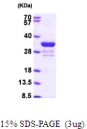 Human Rad1 protein, His tag. GTX67713-pro