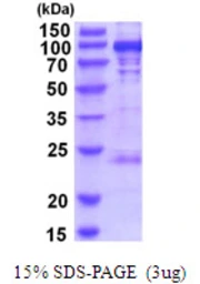 Human PYGL protein, His tag. GTX67717-pro