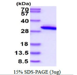 Human QDPR protein, His tag. GTX67718-pro