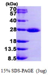Human Rab 1A protein, His tag. GTX67719-pro