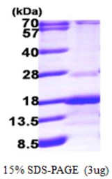 Human RABIF protein, His tag. GTX67730-pro