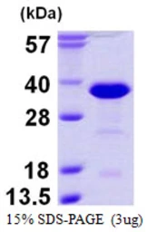 Human RanBP1 protein, His tag. GTX67739-pro