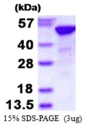 Human RbAp48 protein, His tag. GTX67741-pro