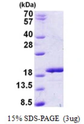 Human RBM3 protein, His tag. GTX67742-pro