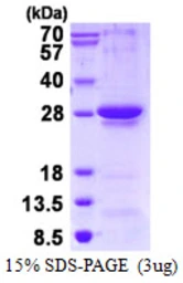 Human RGS1 protein, His tag. GTX67746-pro