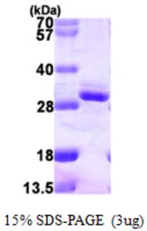 Human RGS2 protein, His tag. GTX67747-pro