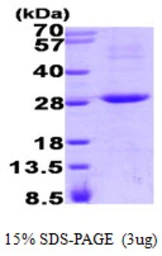Human RGS16 protein, His tag. GTX67750-pro