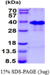 Human RNF4 protein, His tag. GTX67753-pro