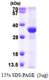 Human RPA32 protein, His tag. GTX67754-pro