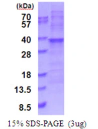 Human RPL7A protein, His tag. GTX67757-pro