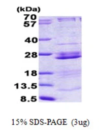 Human RPL23A protein, His tag. GTX67763-pro
