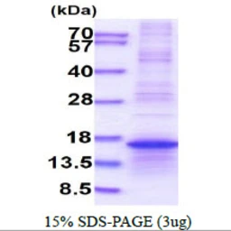 Human RPL35A protein, His tag. GTX67768-pro