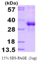 Human RPS3 protein, His tag. GTX67771-pro