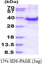 Human RPS3A protein, His tag. GTX67772-pro