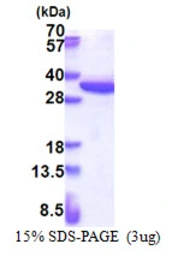 Human RPS4X protein, His tag. GTX67773-pro