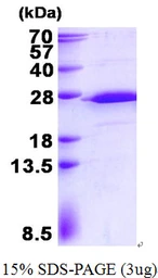 Human RPS5 protein, His tag. GTX67774-pro