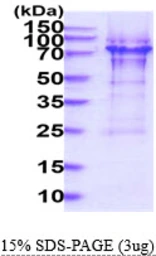 Human p70 S6K protein, His tag. GTX67775-pro
