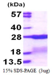 Human RPS7 protein, His tag. GTX67776-pro
