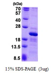 Human RPS10 protein, His tag. GTX67777-pro