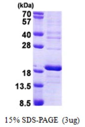 Human RPS16 protein, His tag. GTX67781-pro